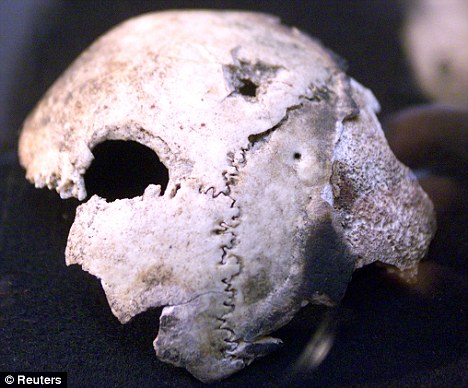 Hitler's skull is really a woman's: New doubts over death after tests 30