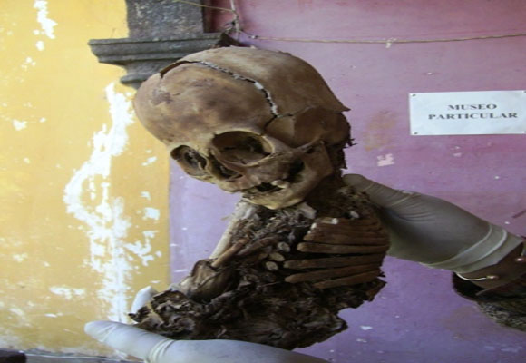 Alien Hybrid Baby Of The Highlands Of Peru Examined By 4 Doctors And 3 Dentists All Say No Hoax 33