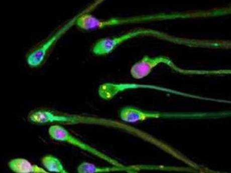 Scientists warn of sperm count crisis 6