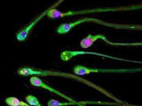 Scientists warn of sperm count crisis 1