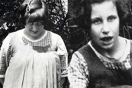Skelette im Schrank: Geheimnisse berühmter Familien 30 nerissa-katherine-bowes-lyon