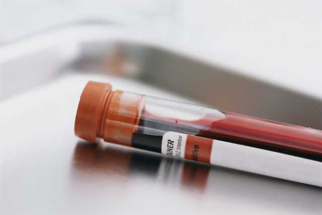 New revolutionary blood test to predict how long you'll live 1