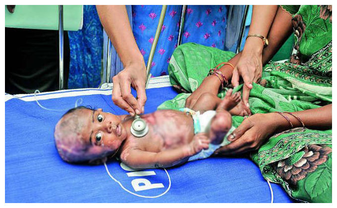 Tamil Nadu's baby Rahul sets on fire by himself 88