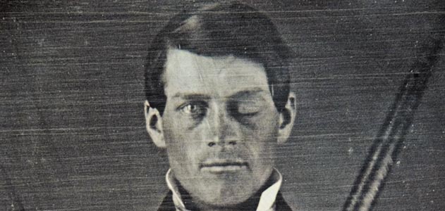 Phineas Gage: Neuroscience's Most Famous Patient 8