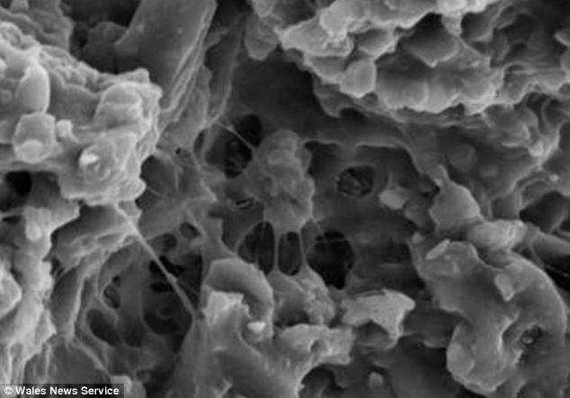 An internal microscopic image of an alien mass of bacteria.
