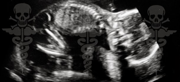Ultrasound Causes Brain Damage in Fetuses: Study 2