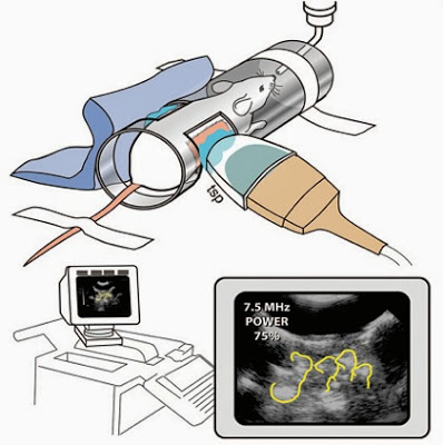 Ultrasound Causes Brain Damage in Fetuses: Study 4