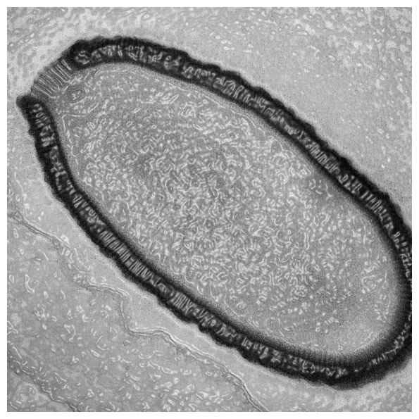Giant virus resurrected from permafrost after 30,000 years 36