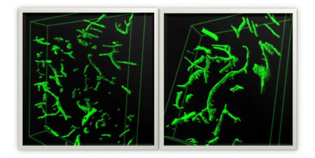 More Evidence That Youthful Blood Can Reverse The Effects Of Aging