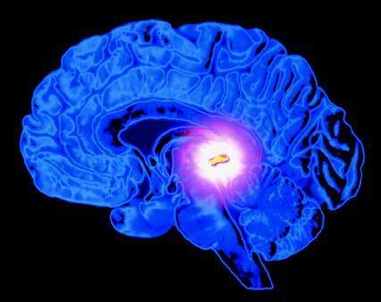 Pineal2