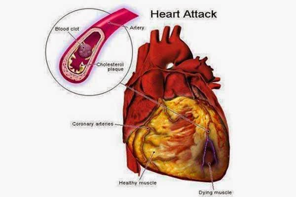 Drinking Water On Empty Stomach 17