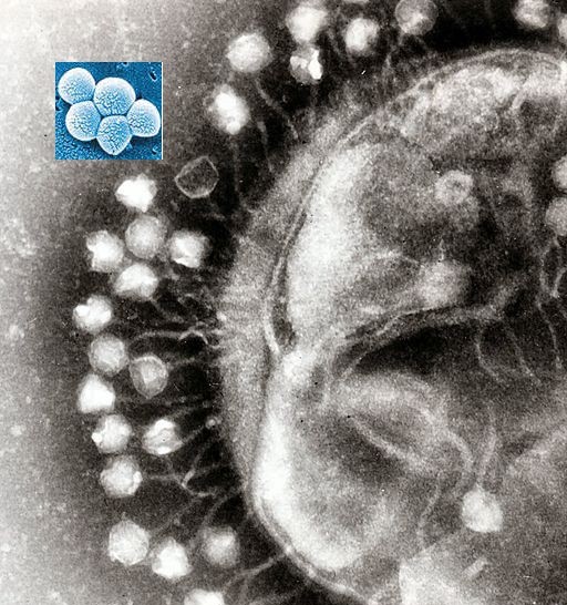 NO MATTER WHAT the story, DO NOT get vaccinated, a new bioweapon is being distributed via vaccines 19