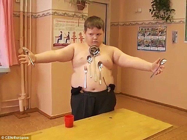 Russian boy electrocuted by lamp post acquires magnetic powers 3
