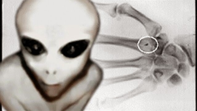 Extraterrestrials, Implants, Kundalini, And Spiritual Ascension 13