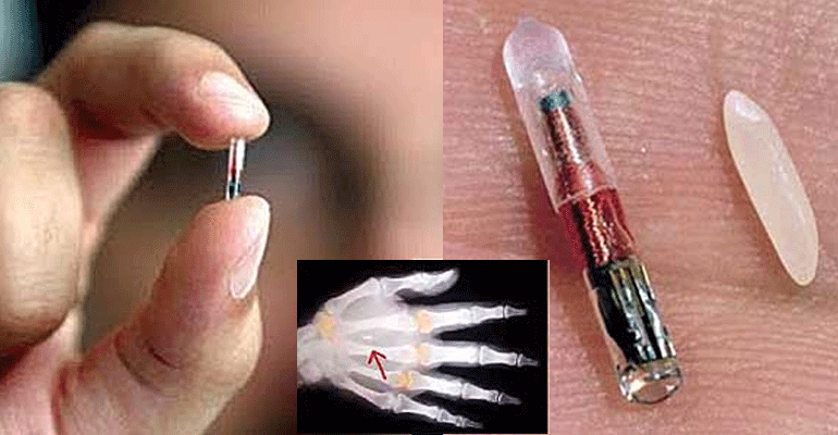 NBC News: 'All Americans Microchipped By 2017'  1