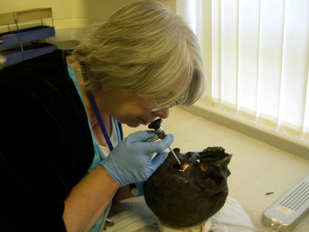 Mind-boggling discovery: Perfectly preserved brain of Iron Age man unearthed in York 13