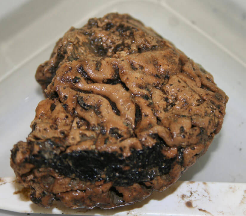 Mind-boggling discovery: Perfectly preserved brain of Iron Age man unearthed in York 25