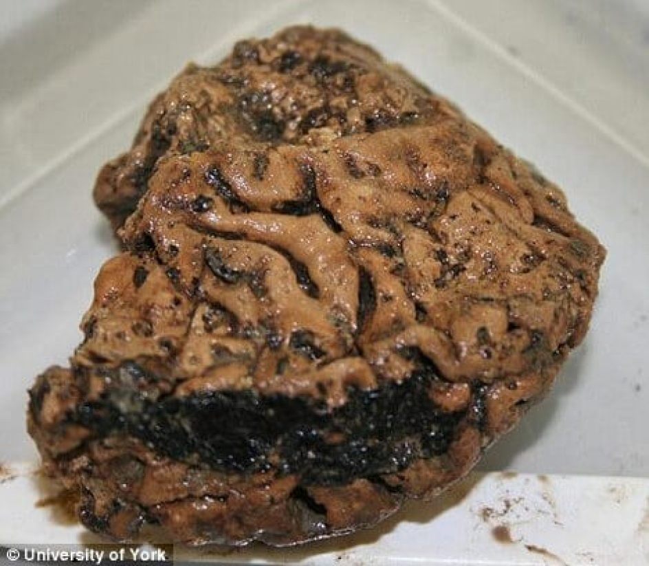 Mind-boggling discovery: Perfectly preserved brain of Iron Age man unearthed in York 12