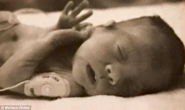 Woman Survived being Aborted after Nurse Heard her Cries from Medical Waste Bin 2