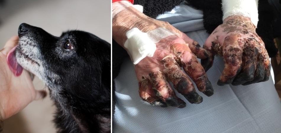 Never Ever Let Your Dog Lick You! Here's Why 17