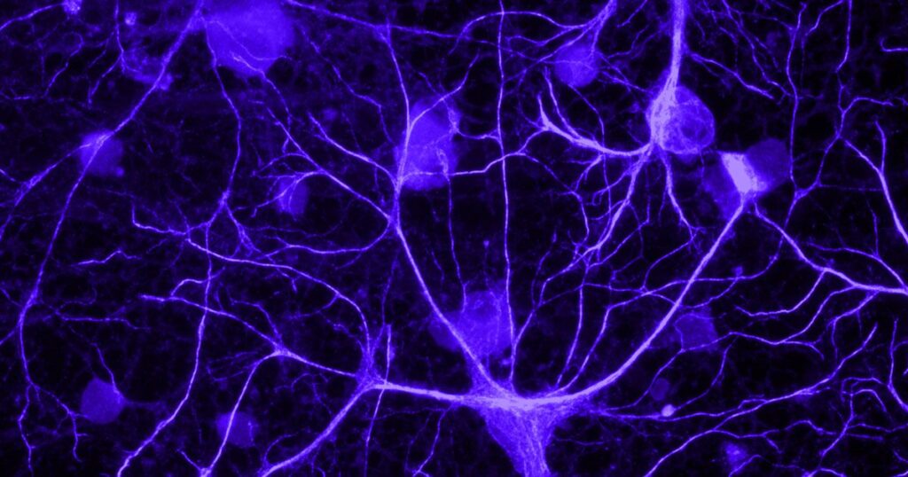 New Drug Combo Could Repair the Brains of Alzheimer’s Patients 3