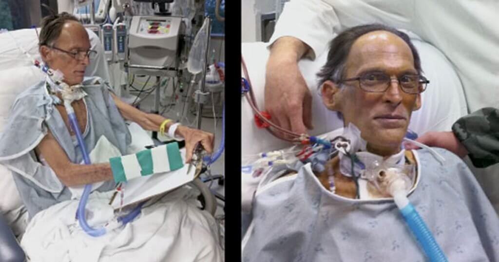 First Heartless Human in The World – He has no pulse 16
