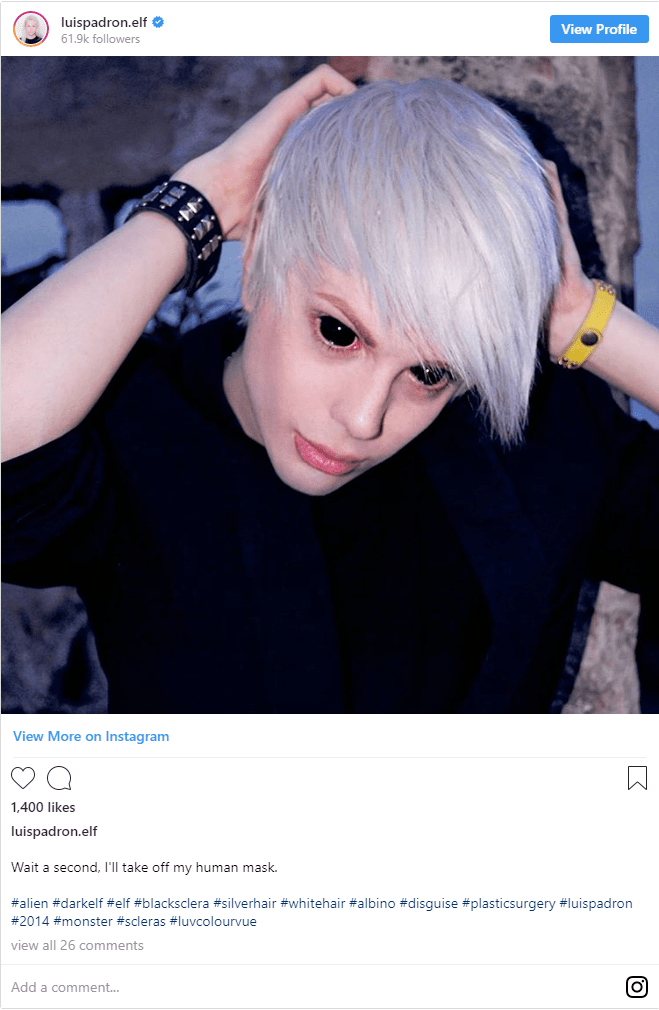 Man Transforms Himself into an 'Elf' 4