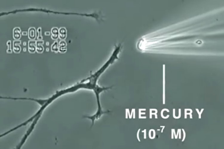 Video Shows What Mercury Does to a Brain Neuron in Just 20 Minutes 9