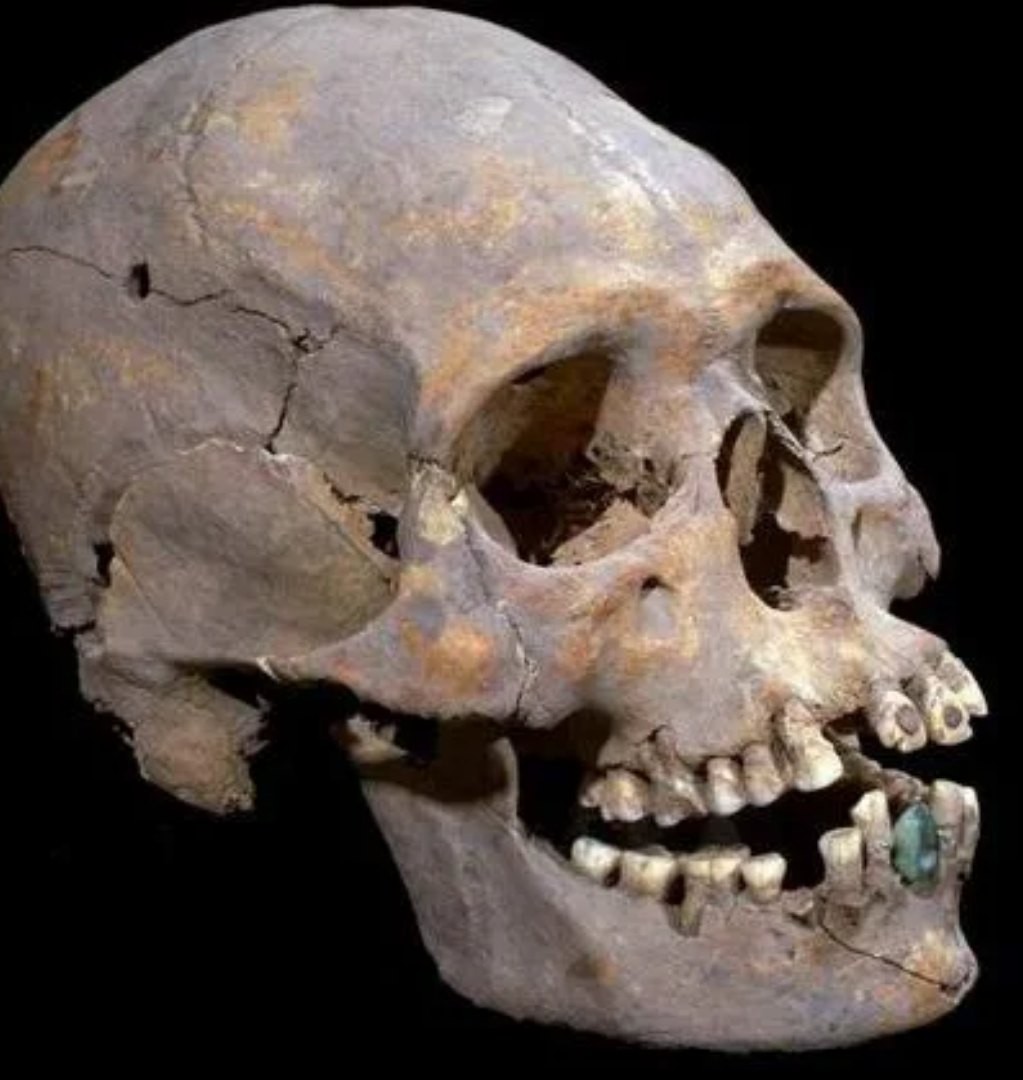 Ancient skull with dentures
