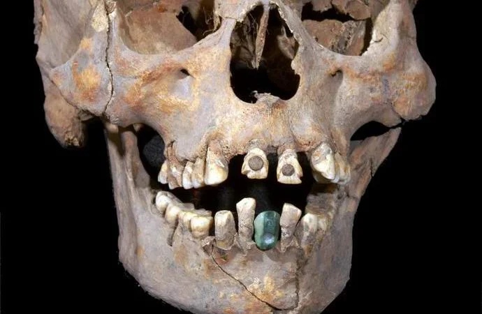 Ein alter Schädel mit Zahnersatz, der in einer mexikanischen Pyramide gefunden wurde 8 Alter Schädel mit Zahnersatz