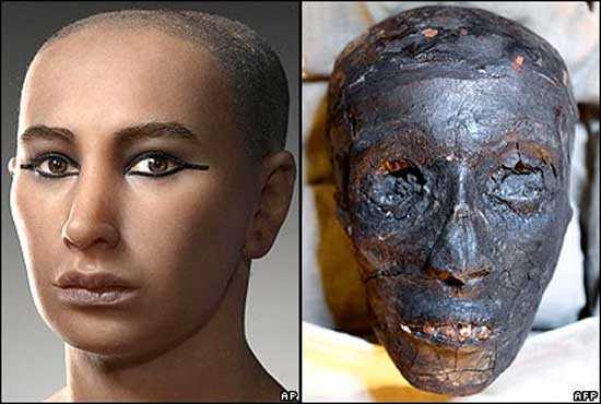 Was Pharaoh Tutankhamun killed, or died from natural causes? 11