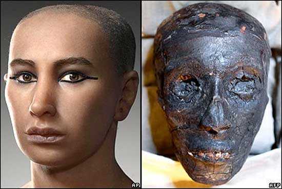 Was Pharaoh Tutankhamun killed, or died from natural causes? 38