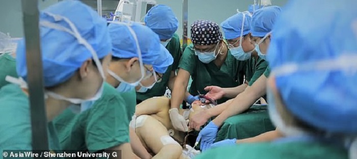 A 20-year-old Chinese resident has been reeling on two ankylosing spondylitis 21