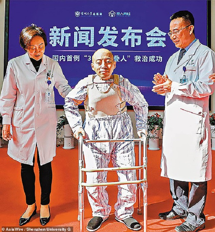 A 20-year-old Chinese resident has been reeling on two ankylosing spondylitis 24