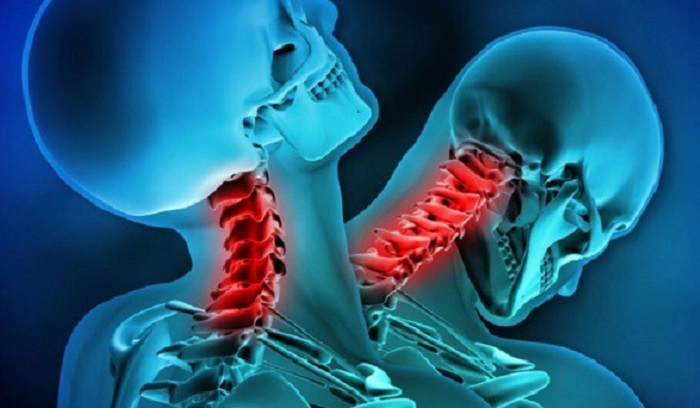 A 20-year-old Chinese resident has been reeling on two ankylosing spondylitis 34