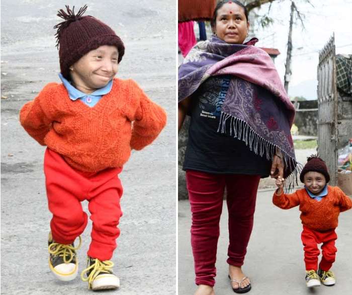 The smallest man in the world died at the age of 27 from pneumonia 53