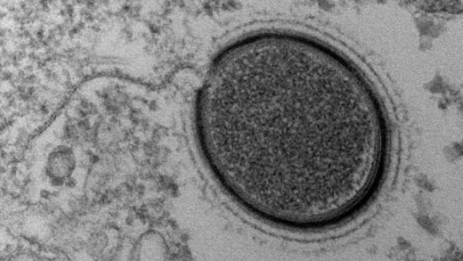 New unknown viruses have appeared on a Tibet glacier 6