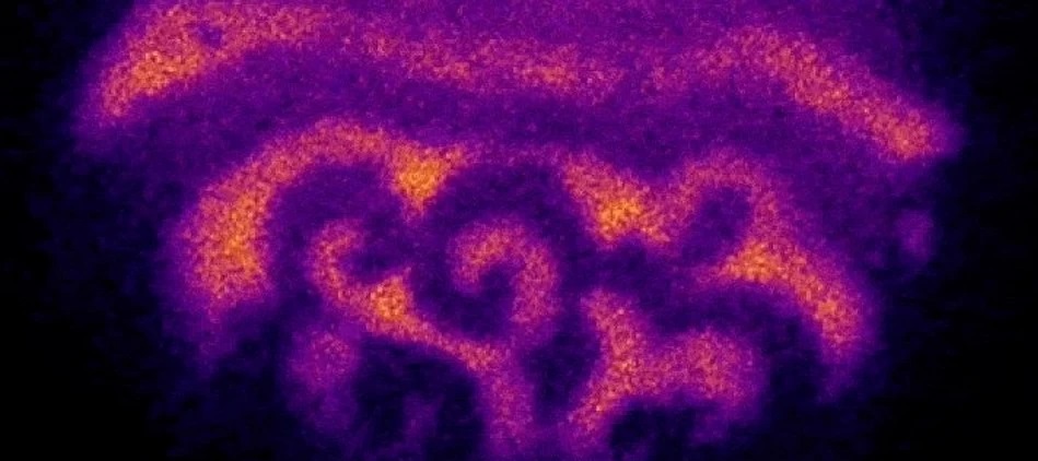 The mysterious phenomenon that accompanies fertilization has been recorded 2