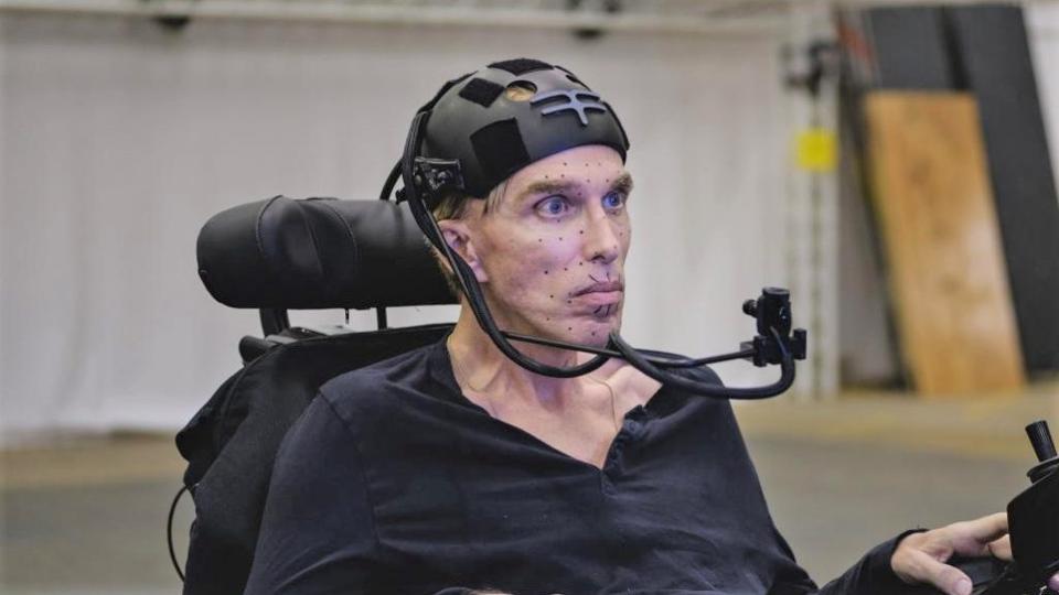 Scientist Peter Scott-Morgan is set to become "the world's first complete cyborg" 19