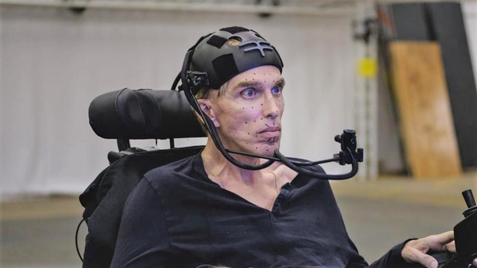 Scientist Peter Scott-Morgan is set to become "the world's first complete cyborg" 28