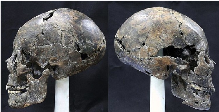 "Inhuman" skull from a Korean grave.