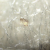 Analysis result: Are these Masked Boogers Living foreign organisms, morgellons? 18