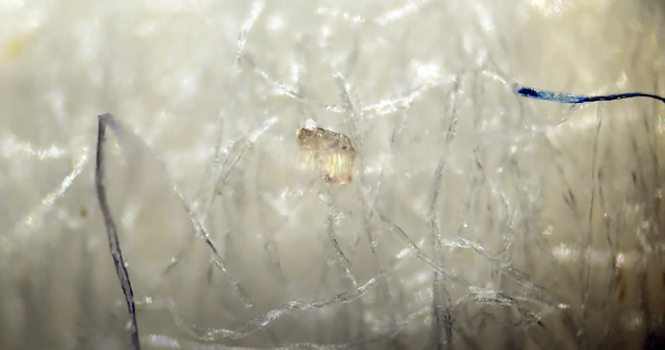 Analyseergebnis: Sind diese Masked Boogers lebende Fremdorganismen, Morgellons? 1 Analyseergebnis: Sind diese Masked Boogers lebende Fremdorganismen, Morgellons? 1