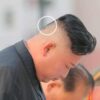 Kim Jong Un has a patch and a green spot on his head 13