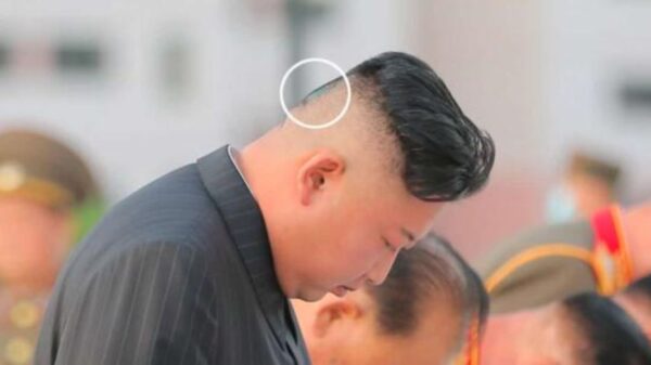 Kim Jong Un has a patch and a green spot on his head 22