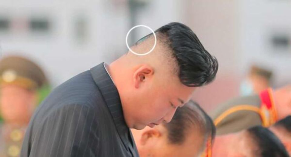 Kim Jong Un has a patch and a green spot on his head 1