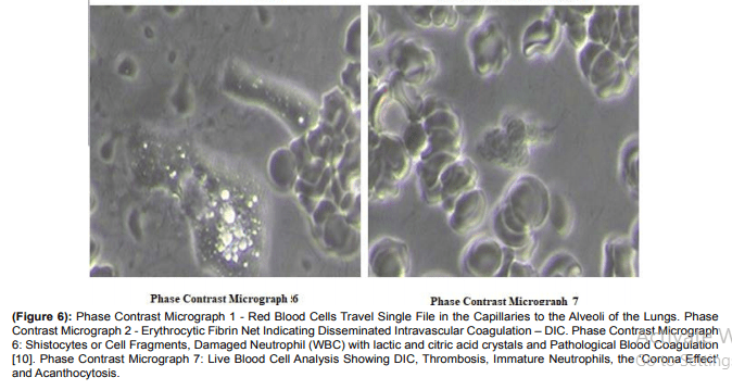 Scientists have found graphene, metal, and even a colony of parasites in vaccines 6