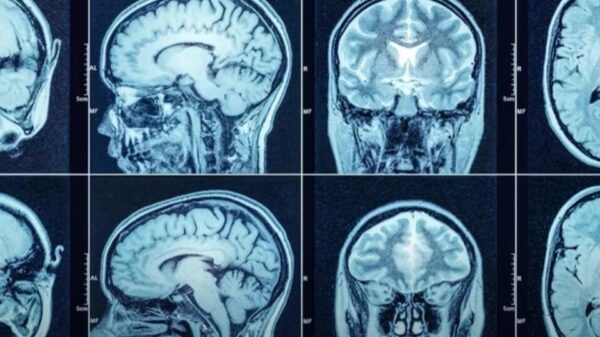 Unusual brain changes found in people who have seen UFOs and aliens 28
