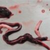 Embalmers find veins and arteries filled with 'never seen before' frighteningly large blood clots 15