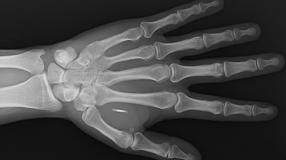 BBC-Auftakt: "Du implantierst einen Mikrochip in deine Hand und kannst alles bezahlen" - So geht's 3 BBC-Auftakt: "Du implantierst einen Mikrochip in deine Hand und kannst alles bezahlen" - So geht's 3